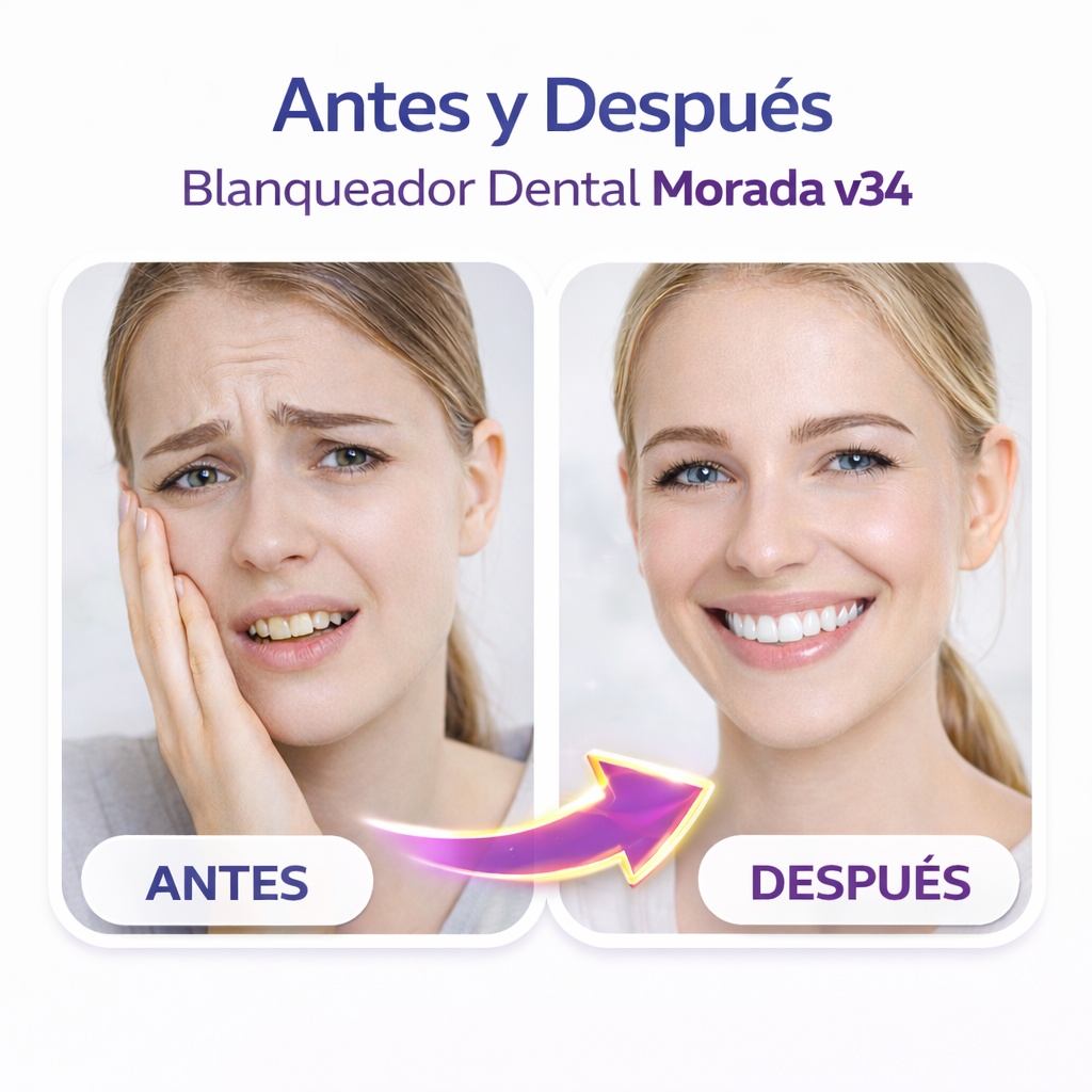 ✨ NEXOR Sonrisa V34 efecto blanqueador inmediato + corrección óptica del tono amarillo 🔥